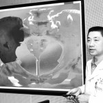 西京医院骨科教授郭征在介绍3D打印钛合金骨头假体临床应用情况。新华社记者 丁海涛摄